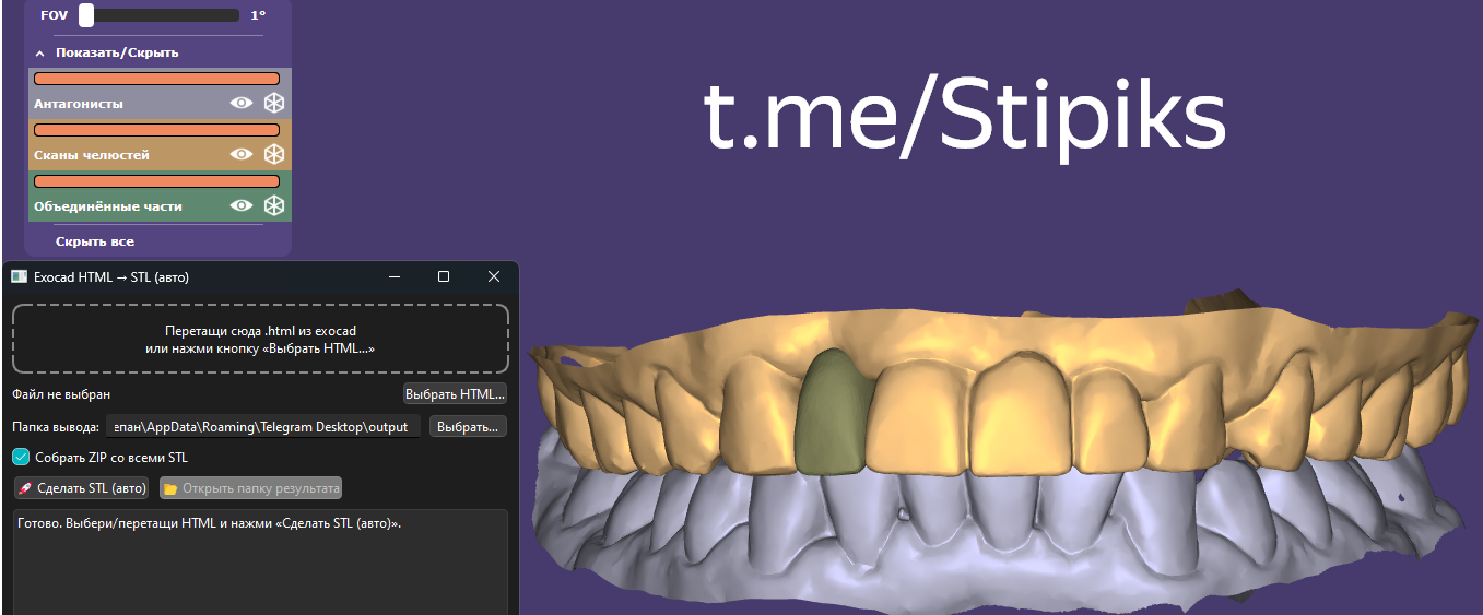Скриншот кейса с моделью STL и контактом Telegram t.me.Stipiks